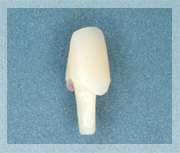 ファイバーコアとは